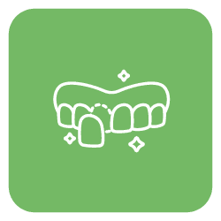 Veneers