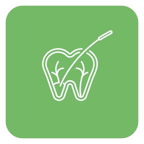 Root Canal Treatment